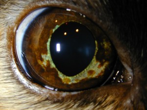 Apuzzo,Ruby OSC Iris melanoma