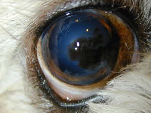 Kantro,Max OD Pigmentary keratopathy