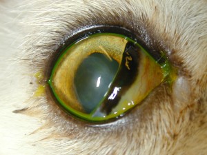 Platt,FelipeAfterSx seq Corneal sequestrum, post-op keratectomy