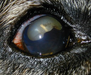 Elliot,Jasmine post synech Iris adhesion to lens from inflammation